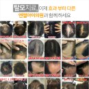 엔젤아이의원 이미지