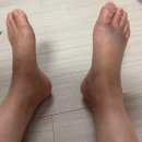 경기중앙동물병원 | 뱀 독소 치료 가능한 병원 찾기(서울·경기 응급실 후기)