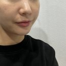 솔샵뷰티 | 천안 성거 피부관리 디또뷰티 천안성거점｜디또 밸런싱케어 1회 효과 솔직후기 💛