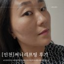 예리오일앤가스 | 인천 청라피부과에서 써니리프팅 받고 온 나의 후기 광고x