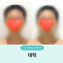 바람빛깔 | 고운빛깔에스테틱 대구점 내돈내산 솔직 후기, 한번 경험으로 만족