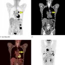 양전자 단층촬영 [positron emission tomography] 이미지