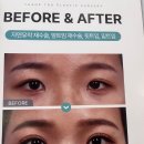 김형석외과의원 | [성형] 땡큐성형외과 김형석