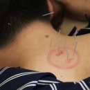 보충한의원 이미지