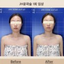 JH 메디 | 대구 북구 피부관리 칠곡 웨딩관리 JH윤곽술｜가율메디스파