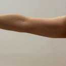 굿모닝김밥천국황상점 | 강남지방분해주사 2회차 후기 : 식단 &amp; 운동 기록으로 본 눈바디 변화