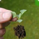 모다올의원 | 모발이식 후 후기와 추천 병원은 어디