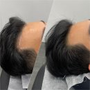홍콩헤어라인