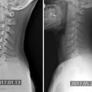 SNPE바른자세 이미지