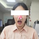 입원해서 개발한 &#39;환절기 비염 완화기&#39;