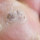 포이즌의원 이미지