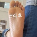 네일리코레푸스 이미지