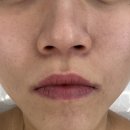 전주 새솔유치원 | [피부관리전문샵] 좋은 제품 듬뿍에 핸들링+기계 피부관리 에코시티 스마일에스테틱