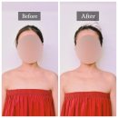 그공간 | 동작구 두피관리 공간슬리밍 브레인테라필링 후기｜예신 승모근 관리·순환케어·금액·위치 총정리