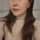 강남피부과 무통증울쎄라 쿨소닉 12000샷 내돈내산 (비포애프터, 통증, 가격, 효과有)
