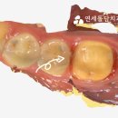 이프라임치과기공소 이미지