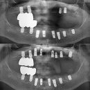 석치과기공소 이미지