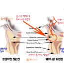 에스에이치 메디칼(SH Medical) | #7 하안검 성형의 선택 – 지방제거 vs 지방재배치, 그 차이와 한계