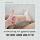 의료용압박스타킹 추천, 붓기 고민으로 신어본 메디지아 제품 착용 후기