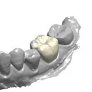 스카이치과기공소 이미지