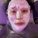 바라봄피부과의원 | [청담] 울쎄라 프라임 + 써마지 각 600샷 후기/엠레드의원 내돈내산(통증, 효과 시기)