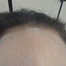 메디라인메디칼 | 닥터오 메디텐션 하이드로겔 마스크, 1일1팩 피부관리 후기