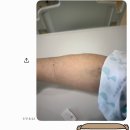 대우병원 | 거제 대우병원 맹장염 수술 리얼찐 후기 초기증상 응급실 CT 비용 과정 총정리(급성충수돌기염 후기)