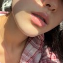 바로서면병원 | 부산 서면 심부볼, 이중턱 온다리프팅 1회차 후기 | 내돈내산, 붓기, 효과, 병원 등