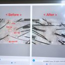 더존케어메디컬 | 위례문제성두피관리✨ 탈모 예방은 올바른 두피 관리 부터 with 모연두피탈모센터