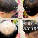 제천가발 이미지