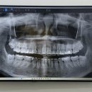 더조은플란트치과의원 이미지