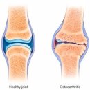 나인원핏 이미지