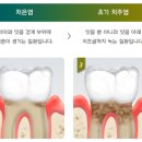 엔젤치과의원 네이버블로그