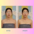 라라에스떼 | 두골비로 핵심만 쏙! 편하고 효과 만점인 비대칭관리 - 부산 안면윤곽관리 라라에스떼