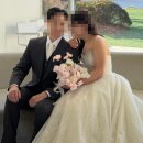 앞구정 | 결혼식 일주일 앞두고 앞구정피부과 팔뚝 온다리프팅 10만줄 후기 효과 본식 사진 포함