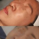 페이스터치 이미지