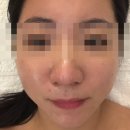 지오프론트 | 운정역피부관리 엘피지오 스타필드빌리지운정점 방문후기