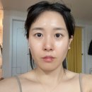 (주)린뷰티 | 린커브 하이 푸 탄력 뷰티 디바이스 꾸준히 사용 후기