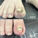 니니네일 이미지