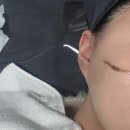 서방사거리 | [광주 계림동] 동구 피부관리 • 웨딩케어 | 스킨플래닝 맛집 ‘수수한 에스테틱’ 내돈내산 후기