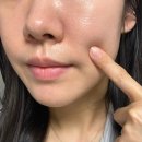 B5 | N통째 사용중인 진정 재생 크림 추천 라로슈포제 B5 내돈내산 후기