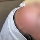 퀸헤어라인 이미지