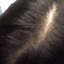 봄철 나의 두피 및 피부관리법 | 두피영양제 탈모예방