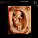 더미즈병원 | 성남 더미즈병원 | 정밀초음파, 입체초음파, 베이비매직 후기 | 12주•24주•28주