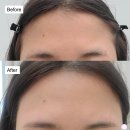 하에르뷰티 | [인천 부평왁싱_리얼리뷰] 얼굴빛이 달라지는 '하에르뷰티' 리얼후기