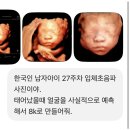 연세맘스그린여성의원 네이버블로그