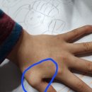 <b>아이</b>가 <b>문구</b>용 칼에 살짝 베였는데요ㅠ