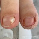 전주효자점 - 레푸스
