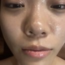 유성메디칼 | 유성 장대동 피부관리 추천 리세스뷰티 윤곽관리 후기