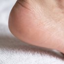 남자의이불 | 남자 발 각질 제거 방법: 발사이즈 290 남자의 페로린 후기